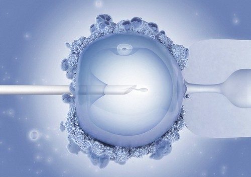 Microscopic view of in vitro fertilisation process showing sperm injected into egg for fertility treatment